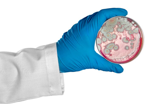 petri dish with bacteria on it